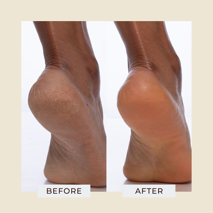 Candlenut Body Polish - 222ml