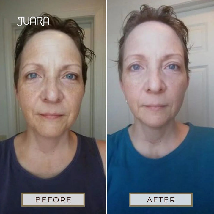 Skin Brightening for Normal to Dry Skin