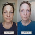 Skin Brightening for Normal to Dry Skin